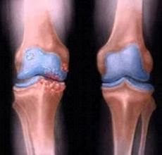 روماتولوژی (Rheumatology)