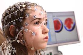 الکترو انسفالوگرام(eeg)